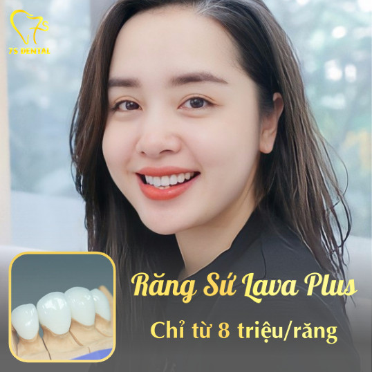 Răng sứ Lava Plus